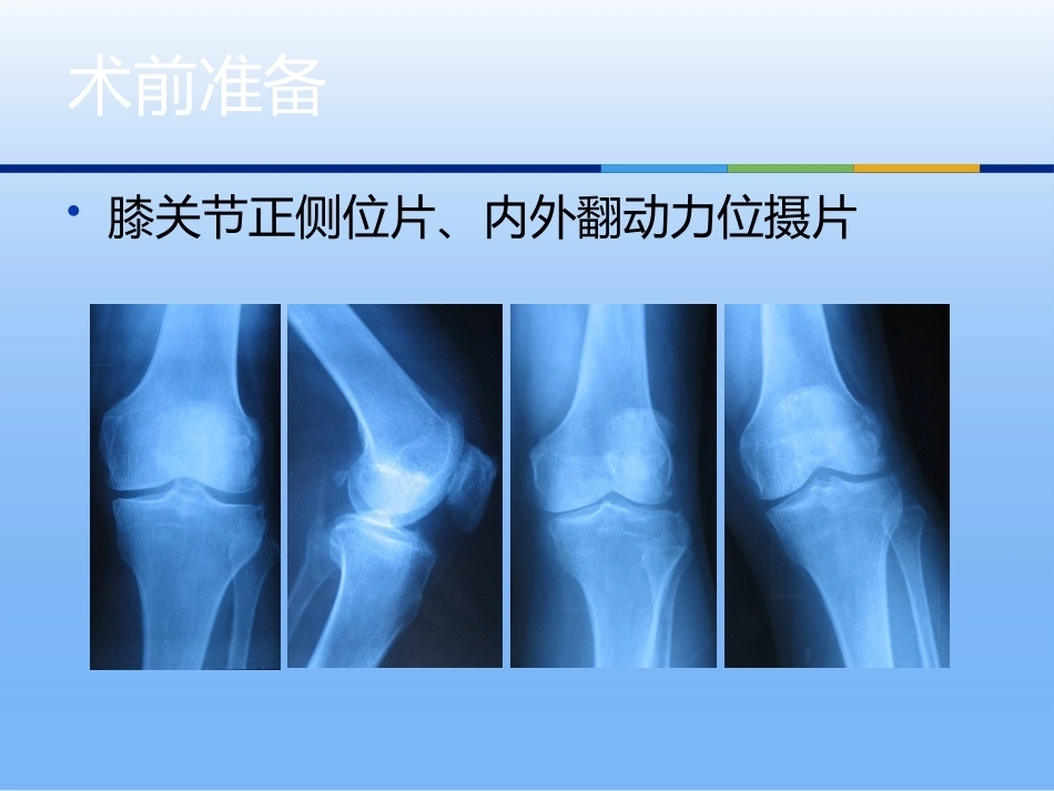 膝关节单髁置换（3）_第9页