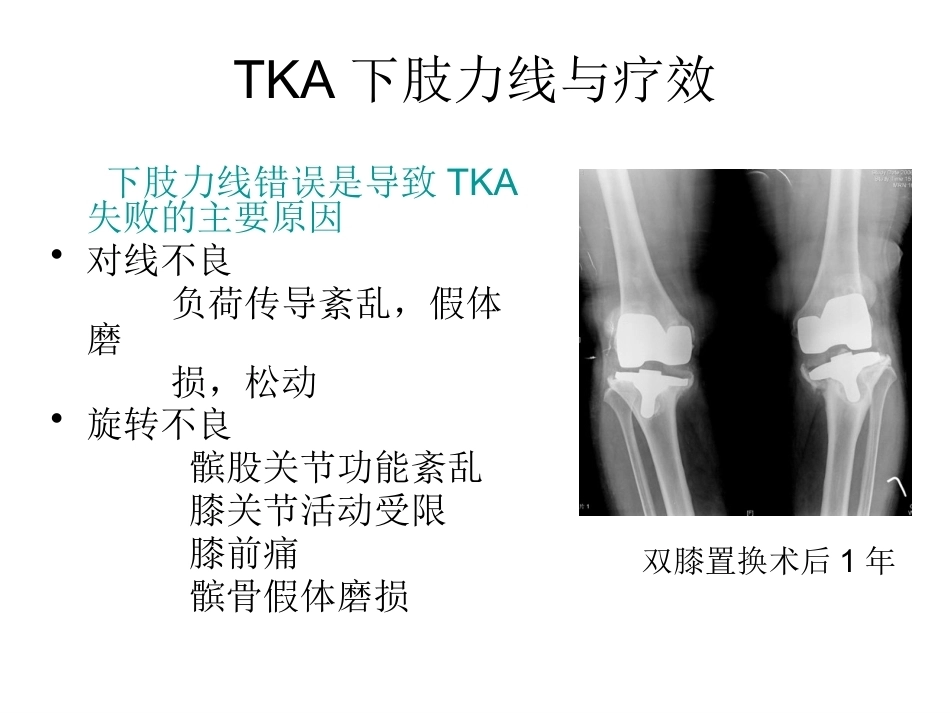 全膝关节置换术力线(3)_第10页