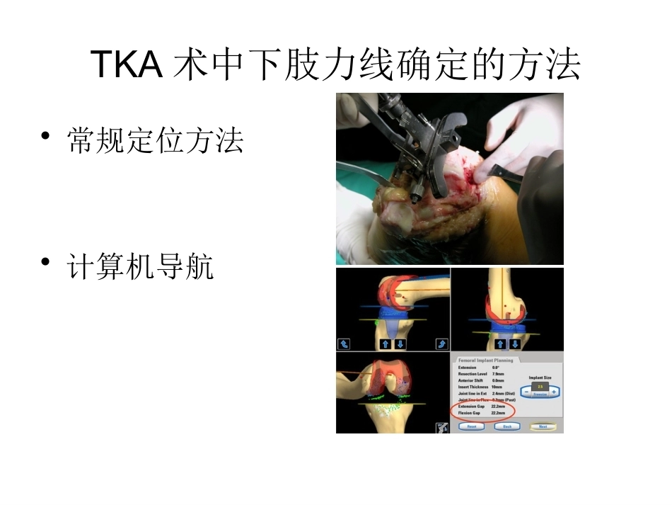 全膝关节置换术力线(3)_第11页
