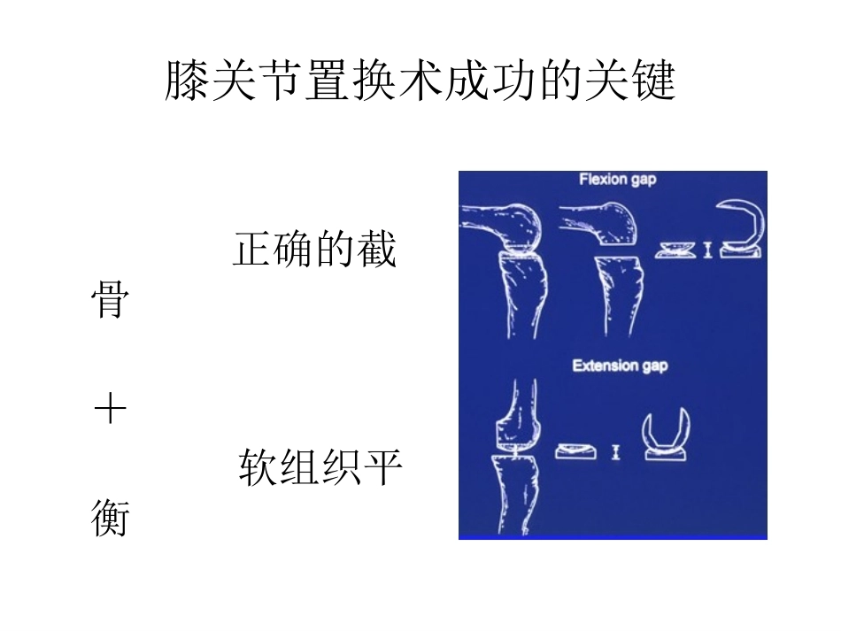 全膝关节置换术力线(3)_第5页