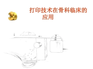 3D打印技术在骨科临床的应用
