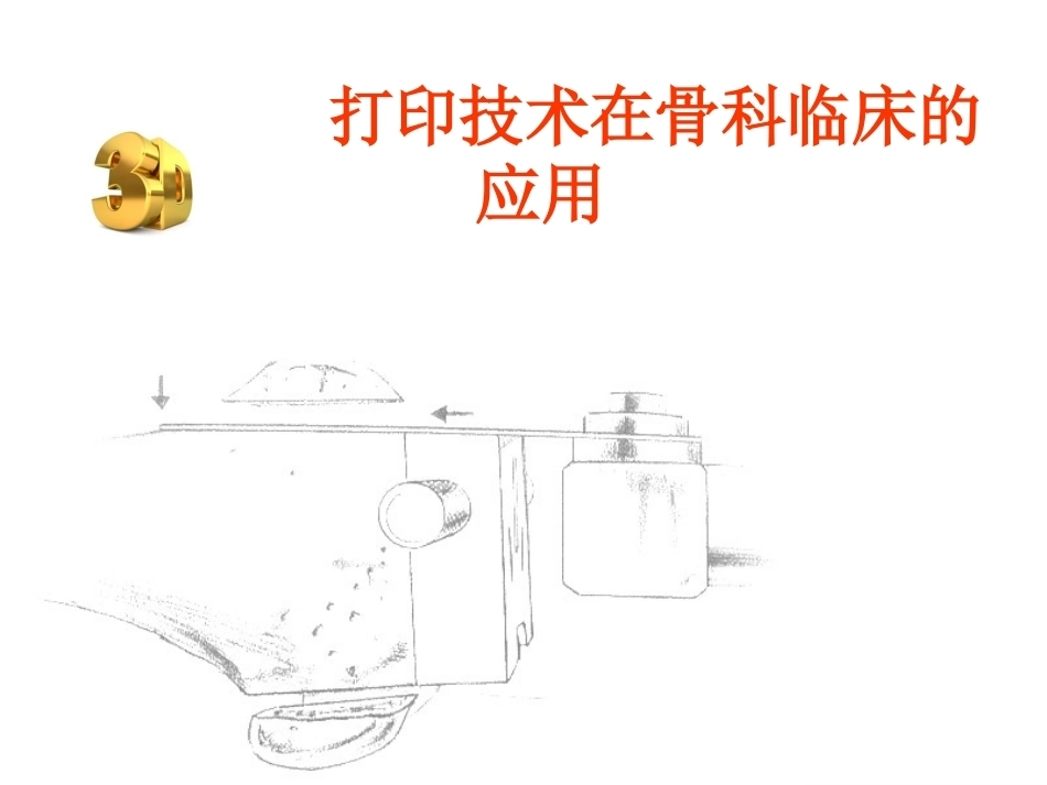 3D打印技术在骨科临床的应用_第1页
