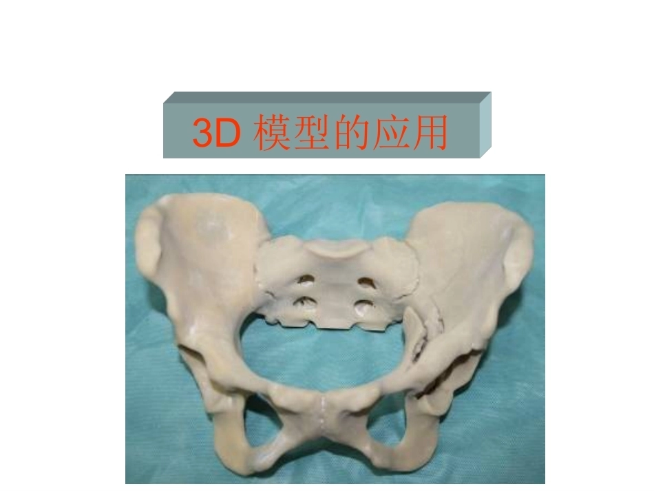 3D打印技术在骨科临床的应用_第7页