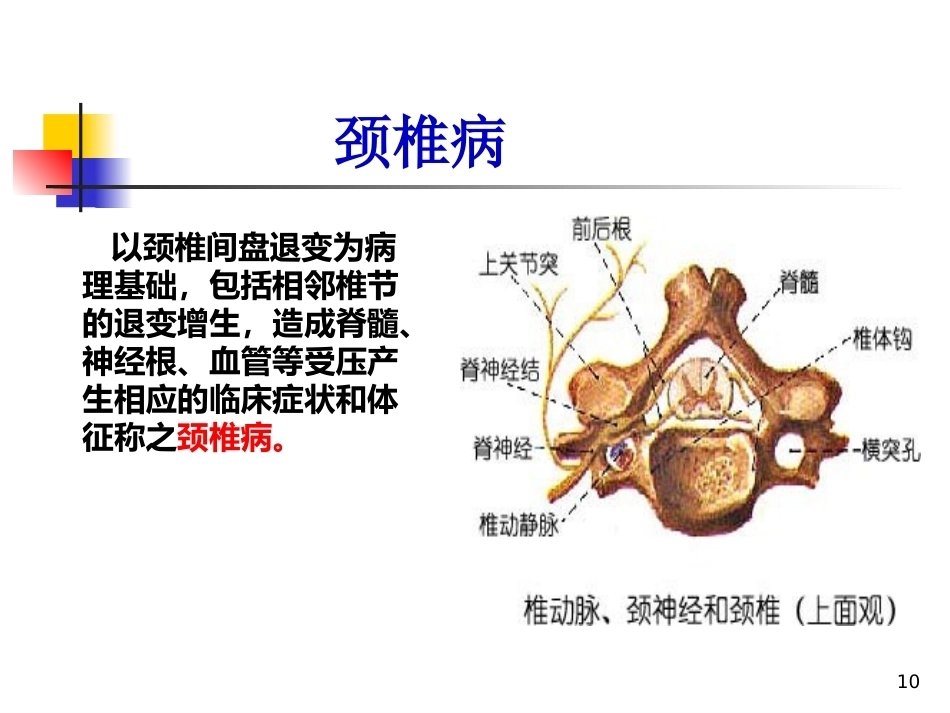 颈椎病的诊断与治疗(3)_第10页
