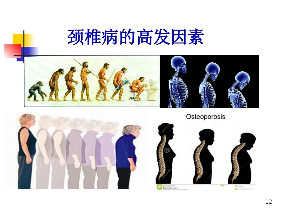 颈椎病的诊断与治疗(3)_第12页