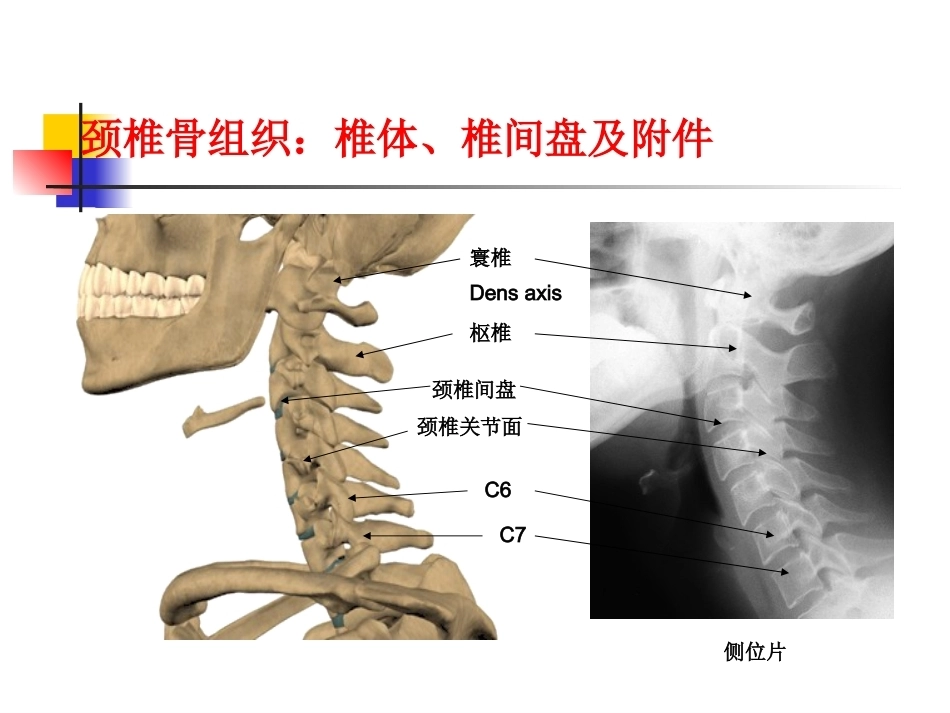 颈椎病的诊断与治疗(3)_第6页