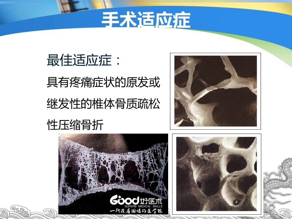 胸腰椎骨折的微创手术治疗(3)_第10页