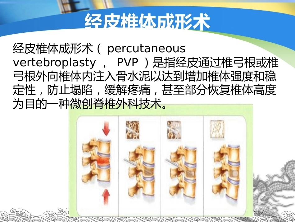 胸腰椎骨折的微创手术治疗(3)_第3页