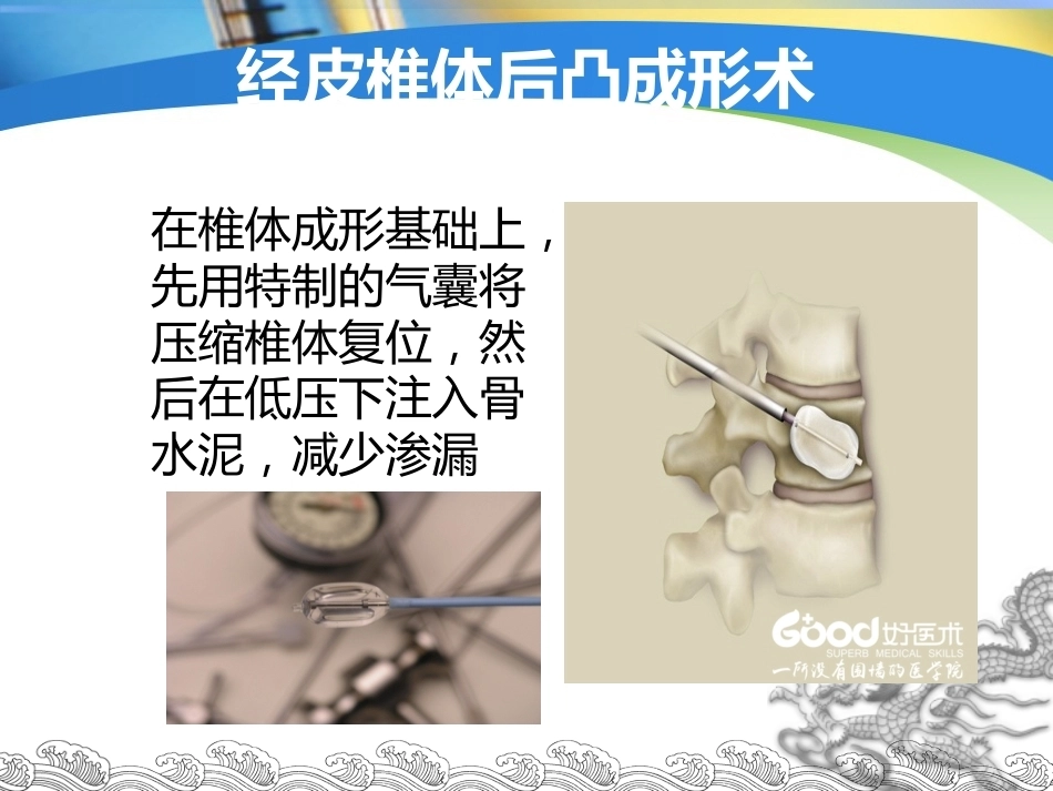 胸腰椎骨折的微创手术治疗(3)_第6页