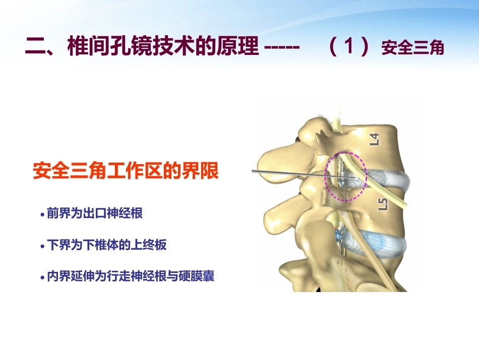 3椎间孔镜技术_第3页