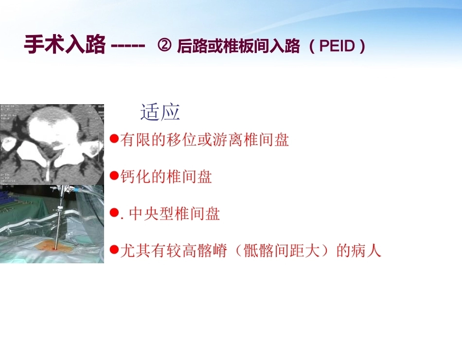 3椎间孔镜技术_第8页