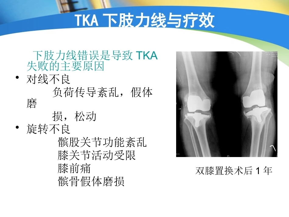 全膝关节置换术力线(4)_第10页