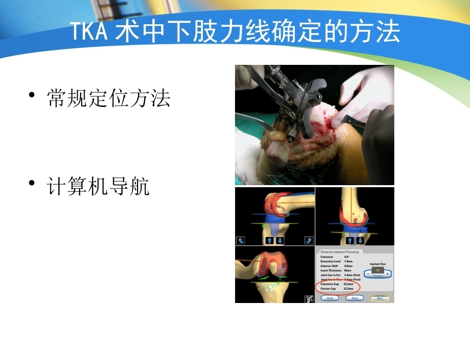 全膝关节置换术力线(4)_第11页