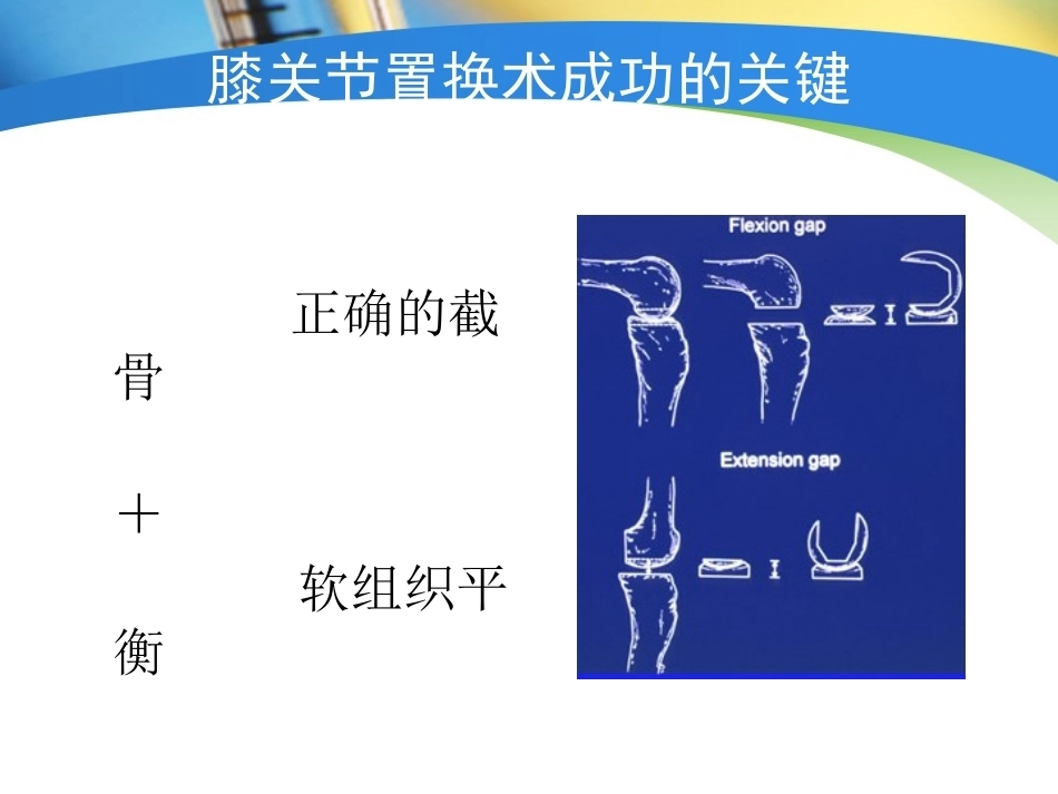 全膝关节置换术力线(4)_第5页