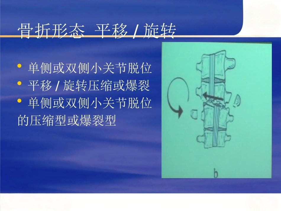 胸腰椎骨折选择治疗(4)_第14页