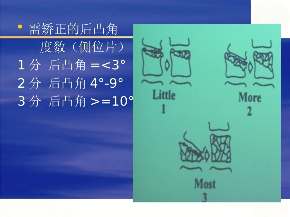 胸腰椎骨折选择治疗(4)_第8页