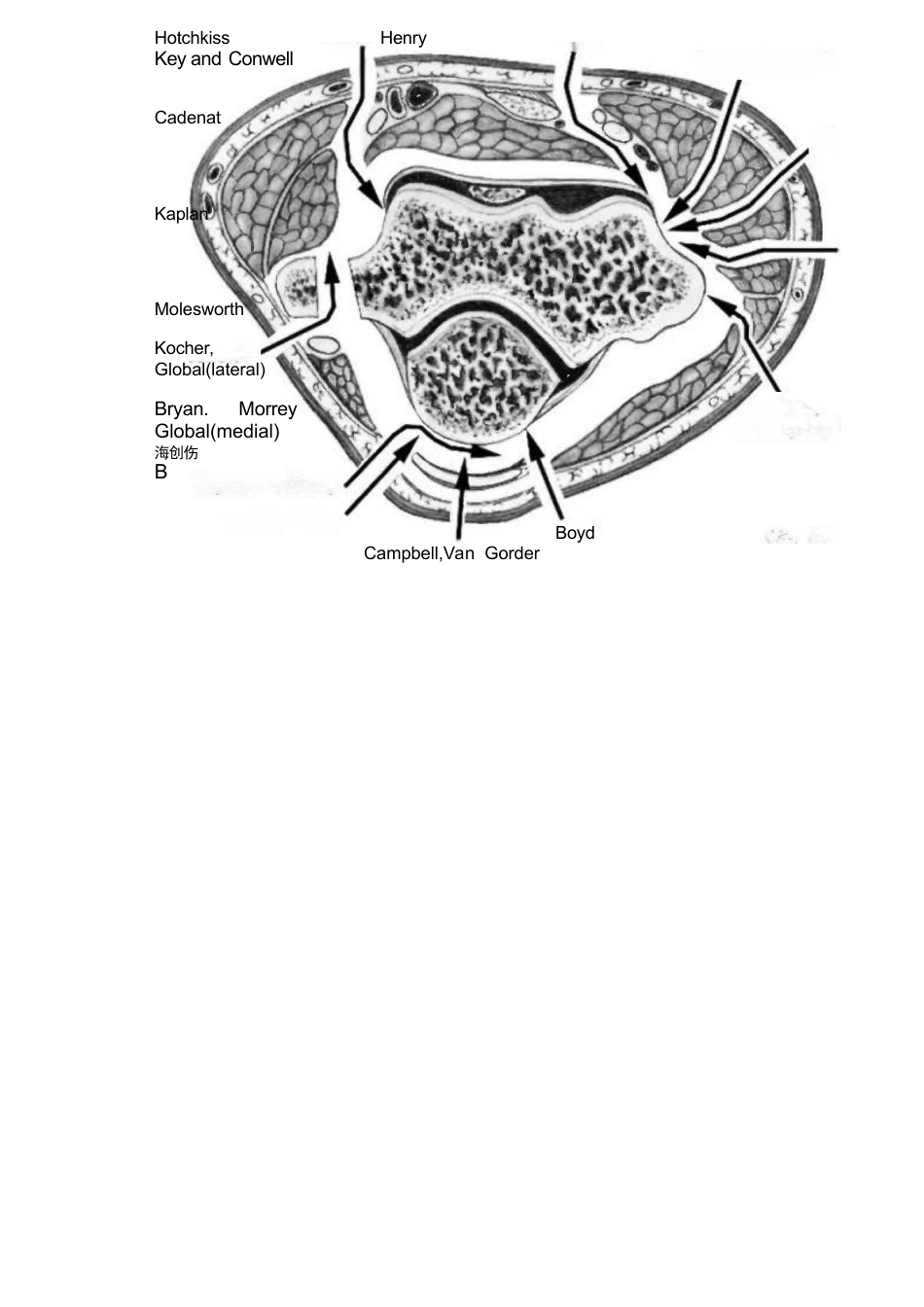 4.肘关节手术入路_第10页