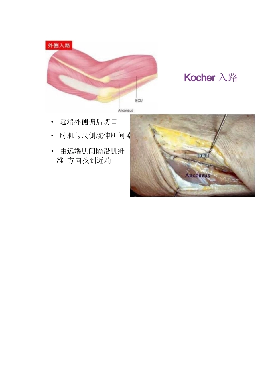 4.肘关节手术入路_第13页