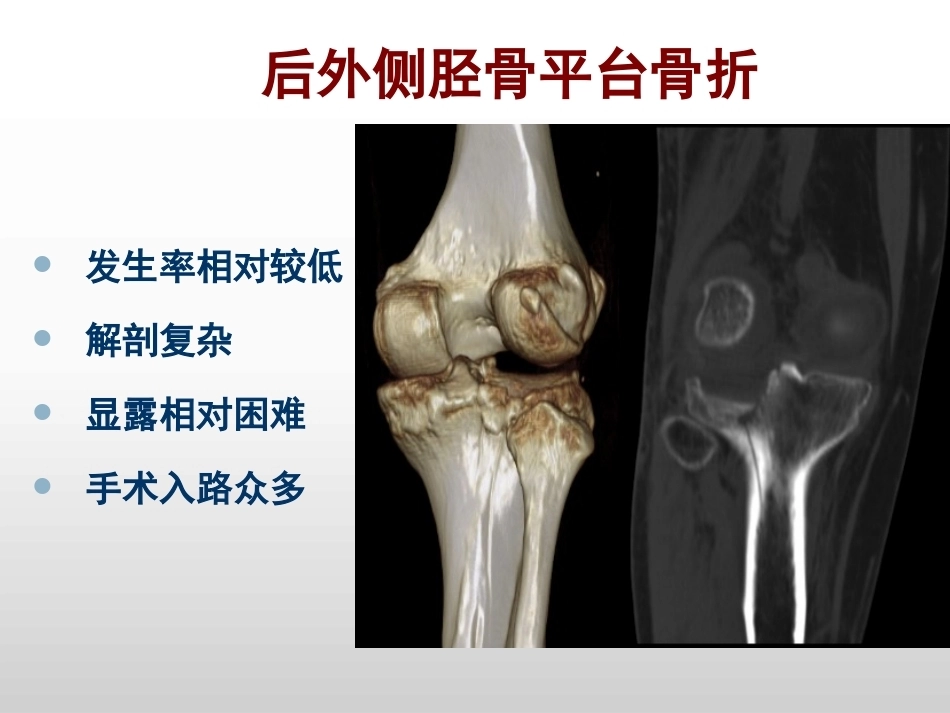 平台后外侧4种入路解剖观察_第2页