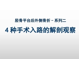 平台后外侧4种入路解剖观察