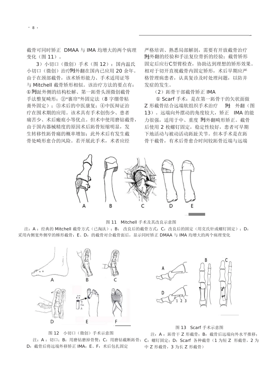 6.拇外翻诊疗专家共识《足踝外科电子杂志》_第8页