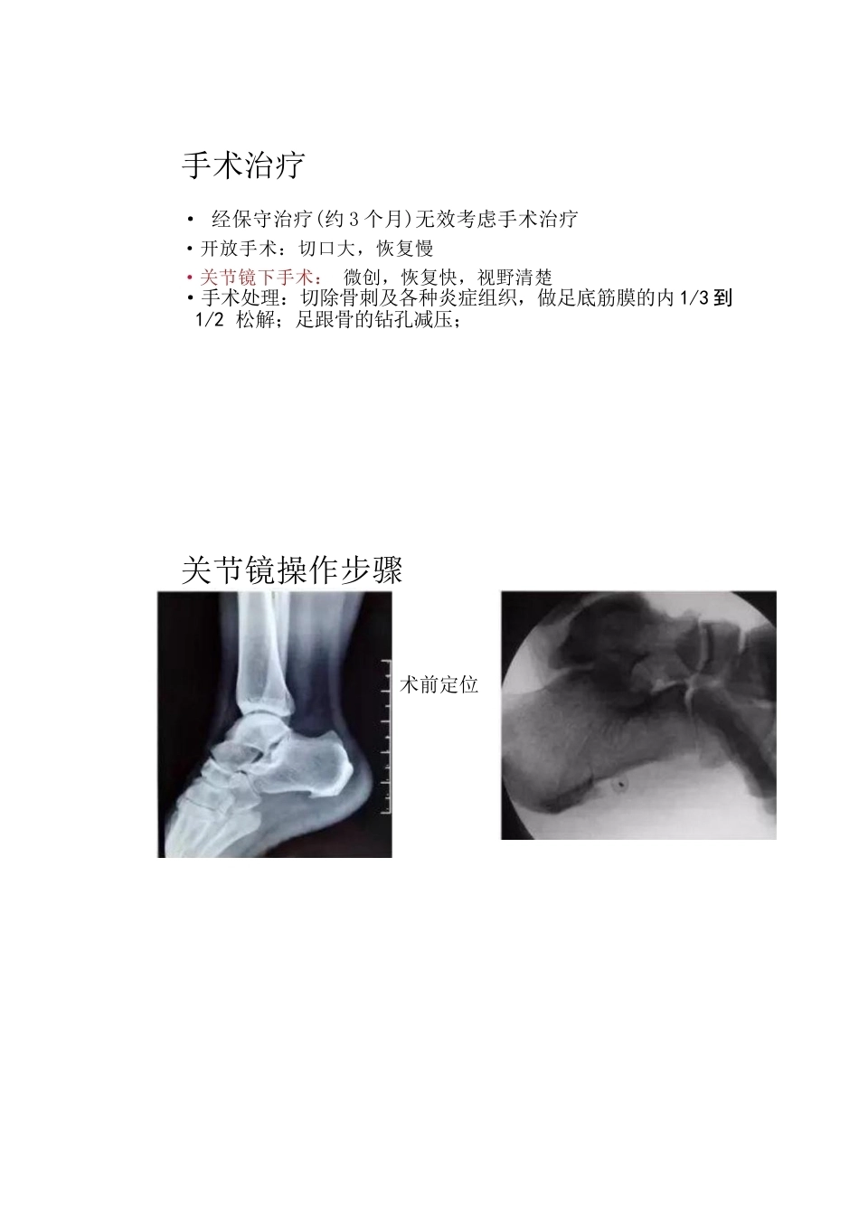 7椎体终板炎_第3页