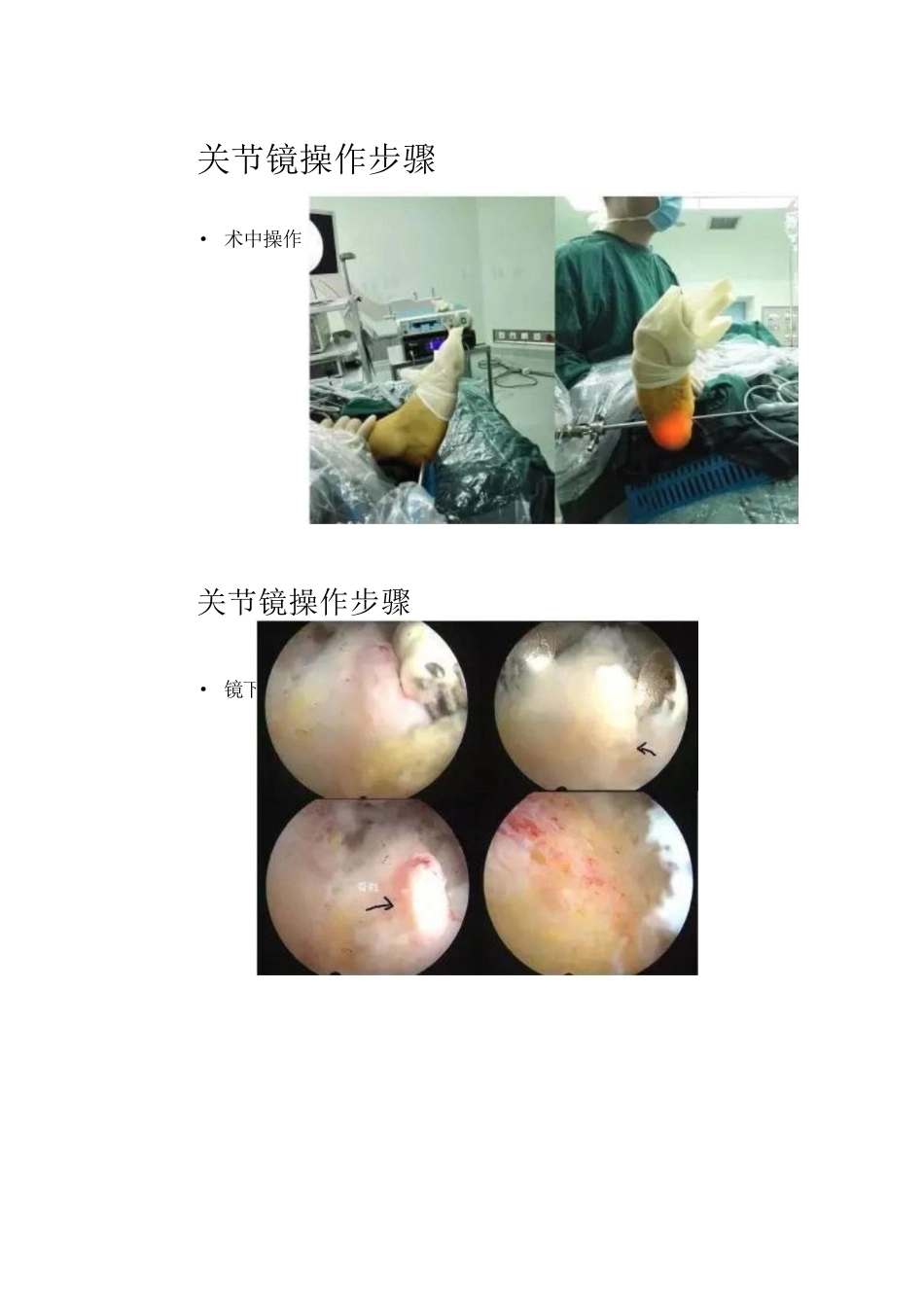 7椎体终板炎_第4页