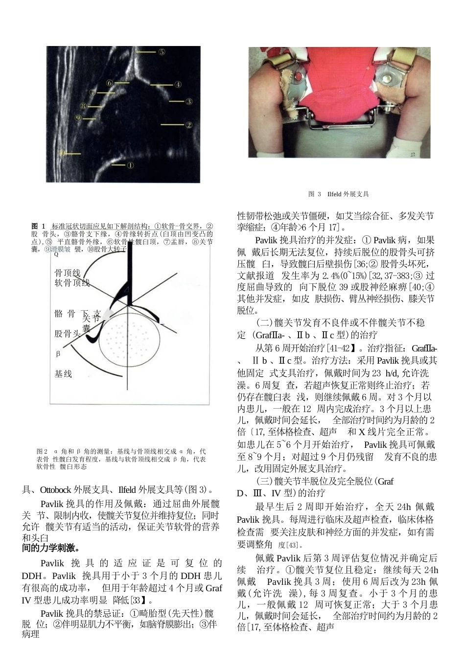 8.发育性髋关节发育不良临床诊疗指南(0～2岁)_第5页