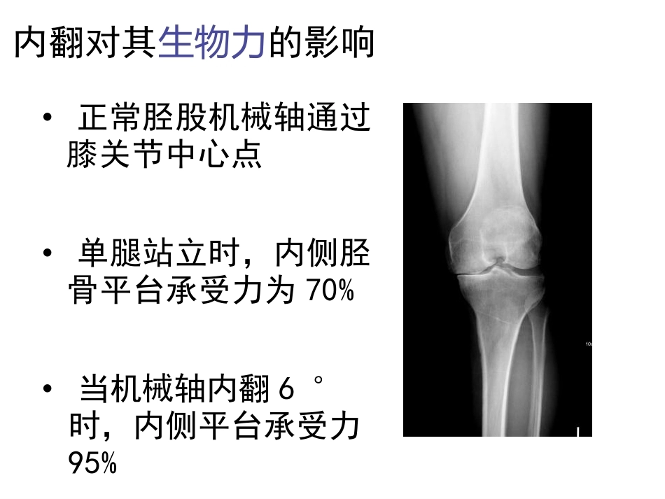数字截骨(21)_第10页