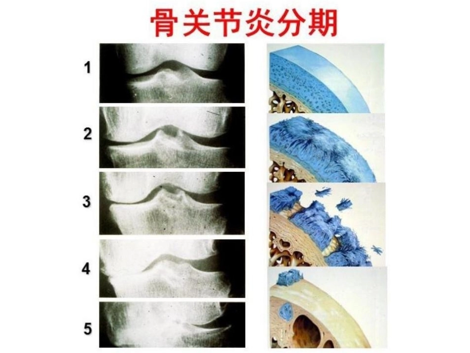 数字截骨(21)_第11页