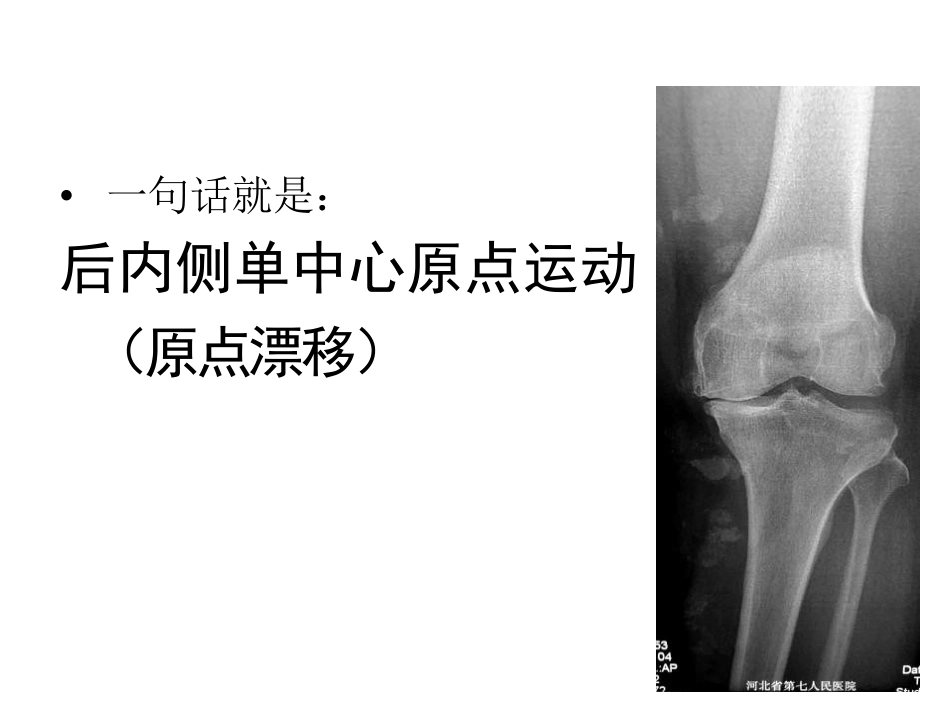数字截骨(21)_第15页