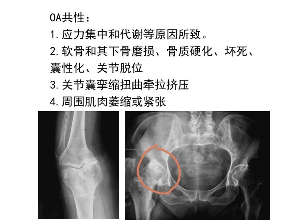 数字截骨(21)_第4页