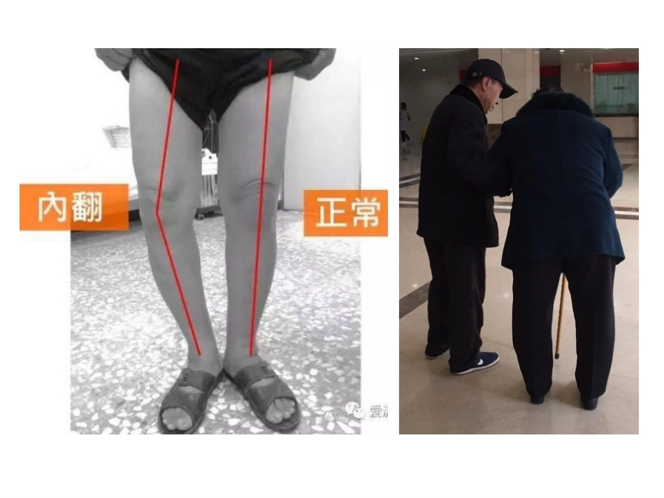 数字截骨(21)_第7页