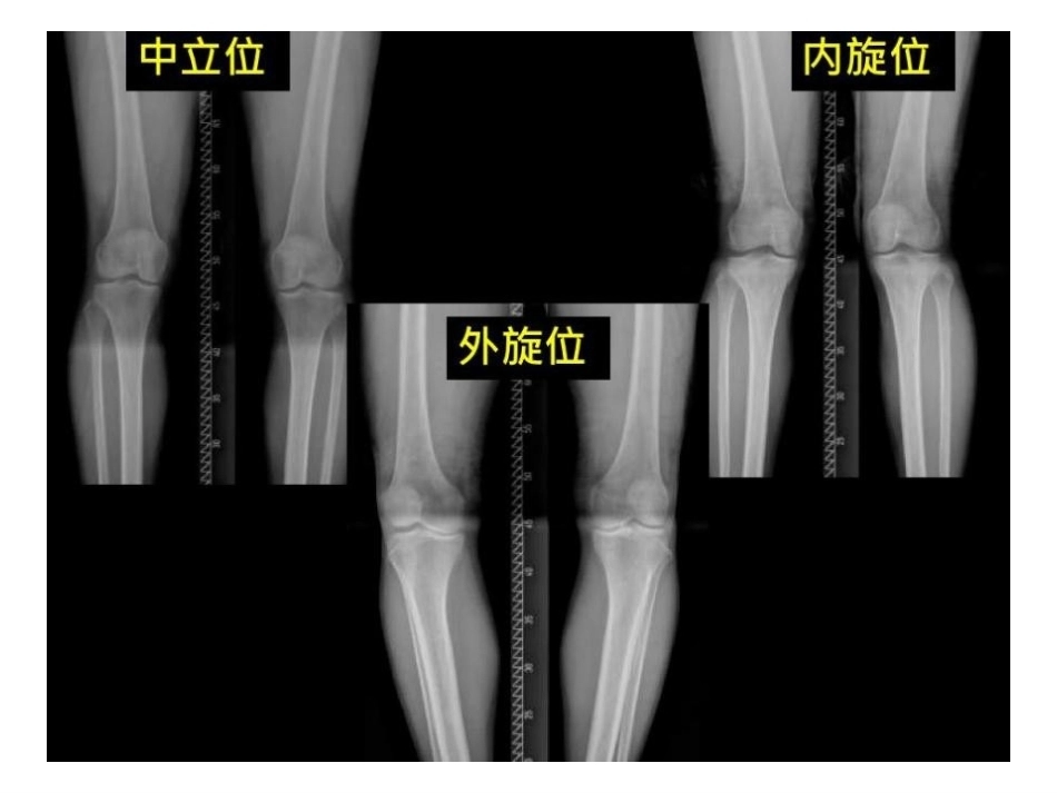 数字截骨(21)_第9页