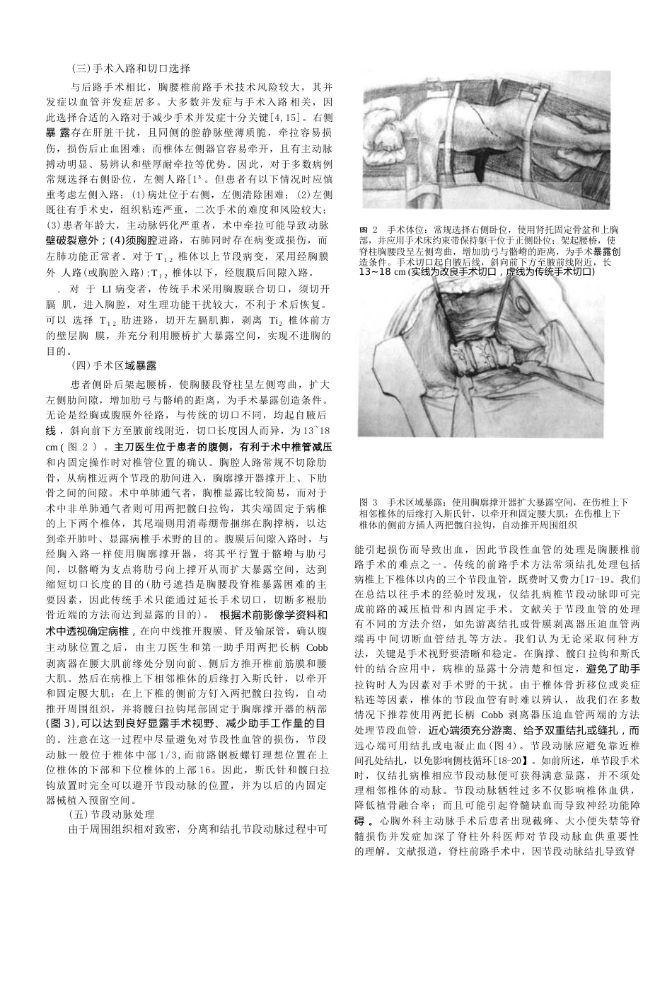 26.骨科教程： 胸腰椎骨折前路手术技术改良_第2页