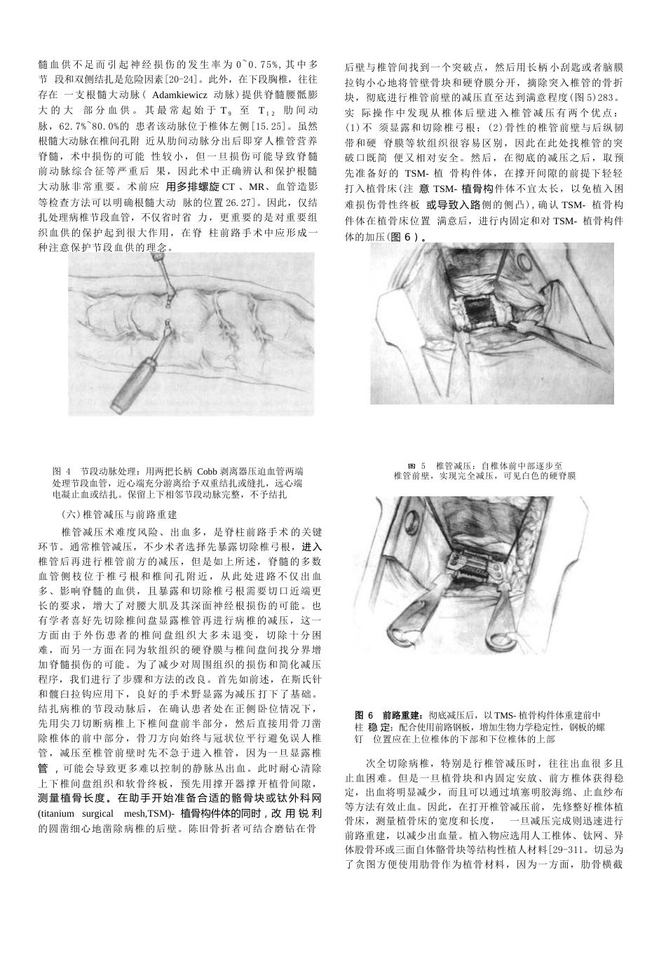 26.骨科教程： 胸腰椎骨折前路手术技术改良_第3页