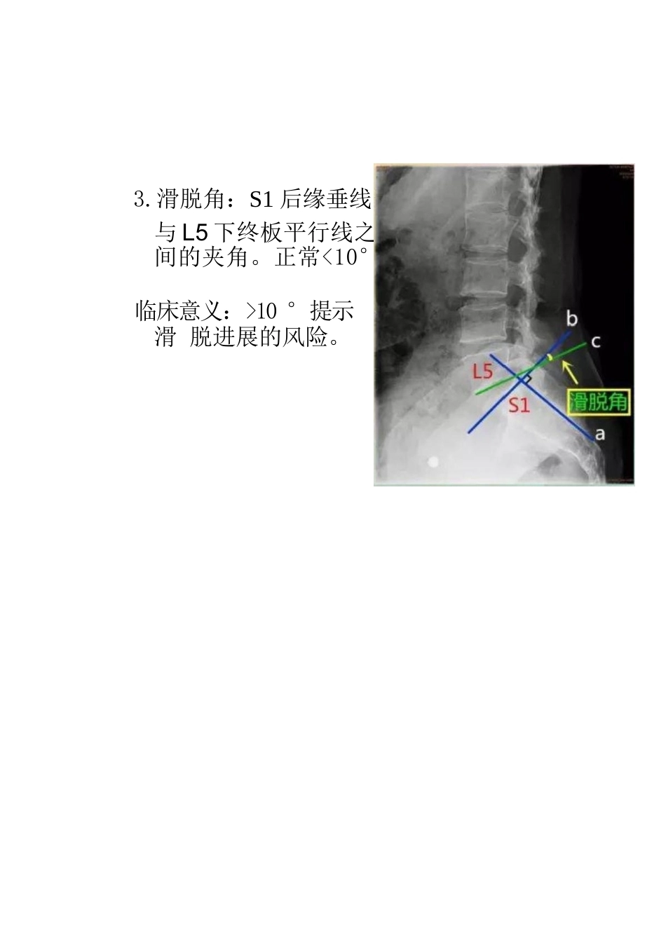 28.骨科常用的一些角度参数_第4页