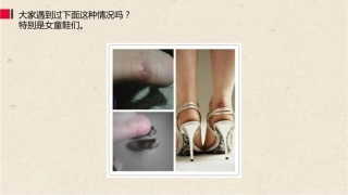 38.关节镜治疗Haglund综合征