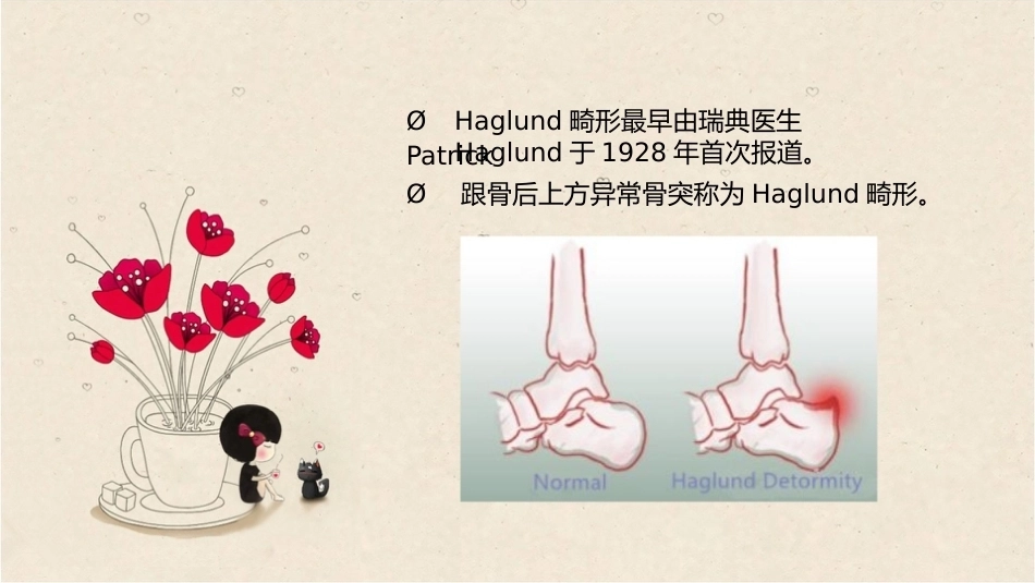 38.关节镜治疗Haglund综合征_第4页