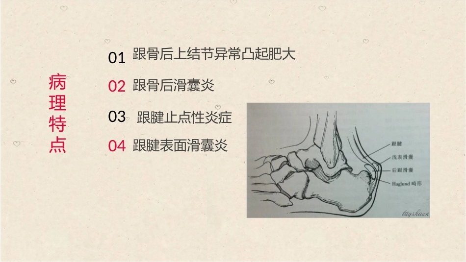 38.关节镜治疗Haglund综合征_第6页