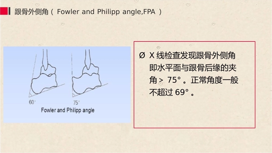 38.关节镜治疗Haglund综合征_第8页