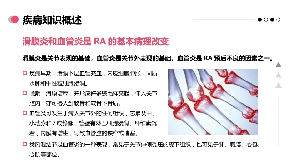 类风湿关节炎病人的护理_第7页