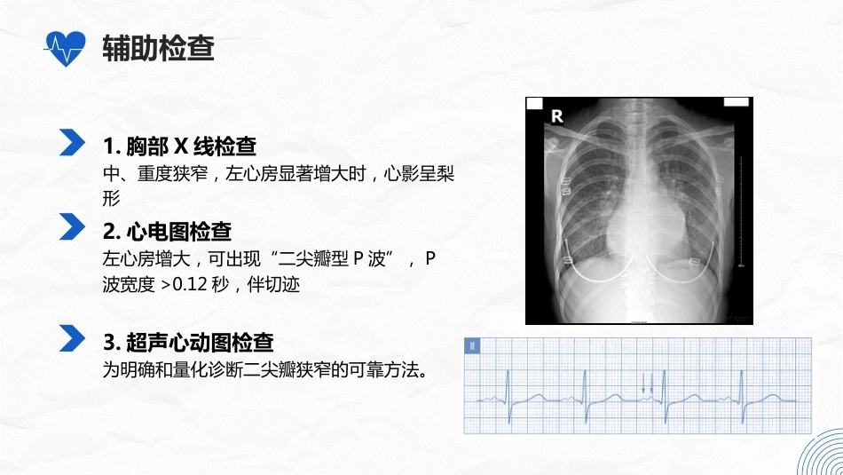 二尖瓣狭窄病人的护理_第12页
