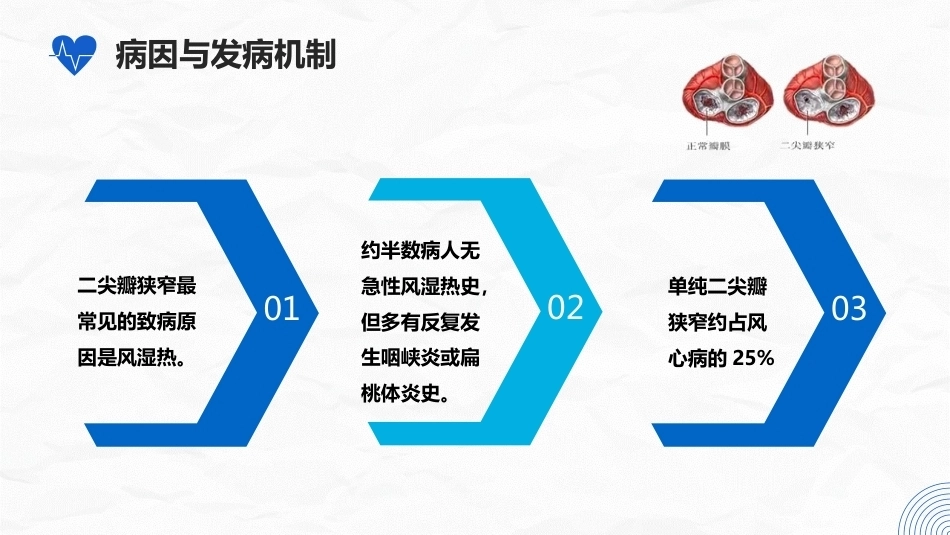 二尖瓣狭窄病人的护理_第5页