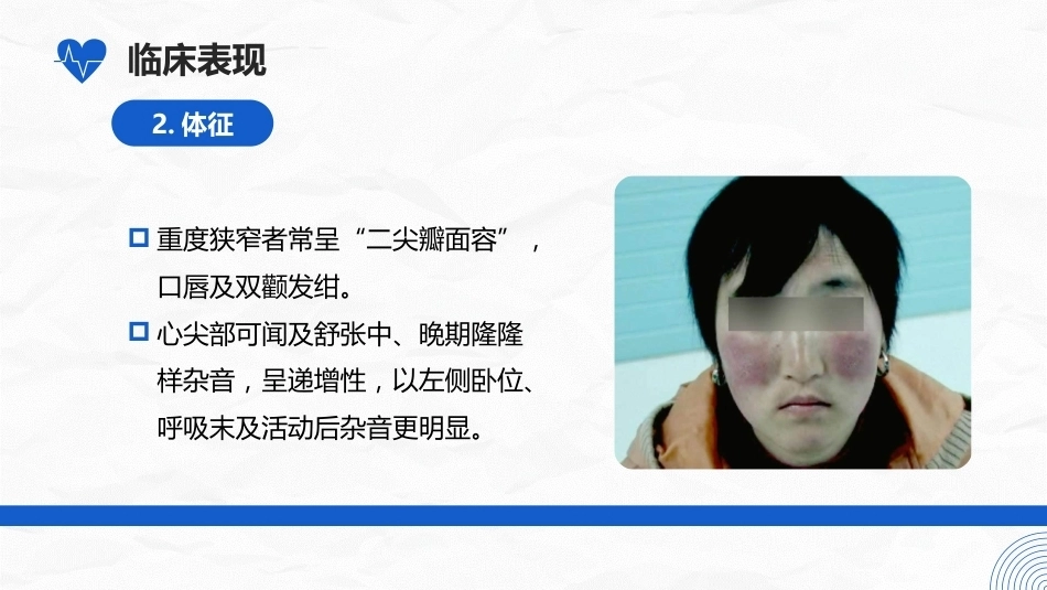 二尖瓣狭窄病人的护理_第9页