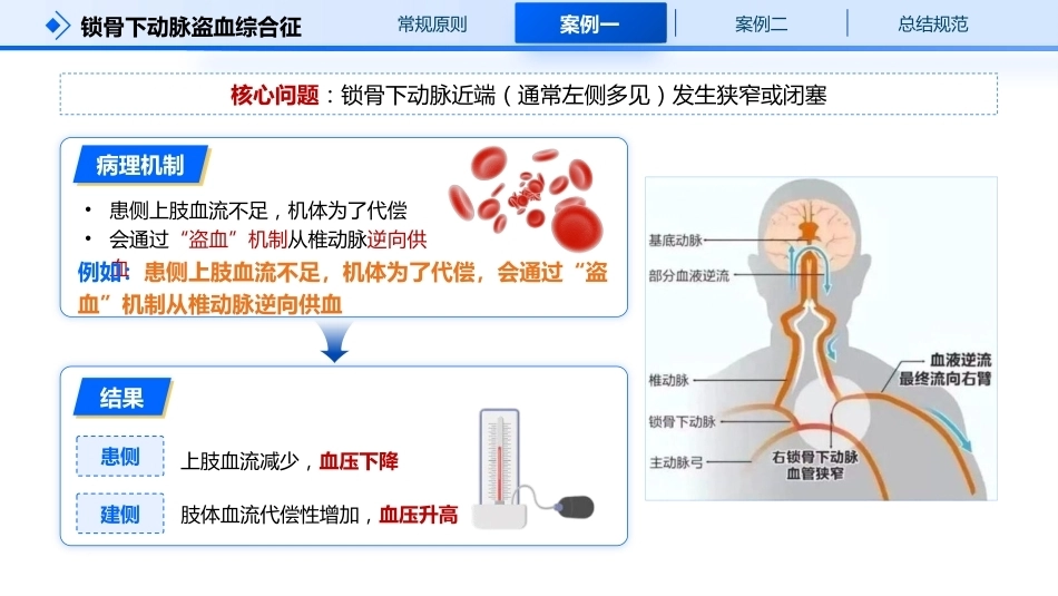测血压是以左臂为准还是右臂？_第5页