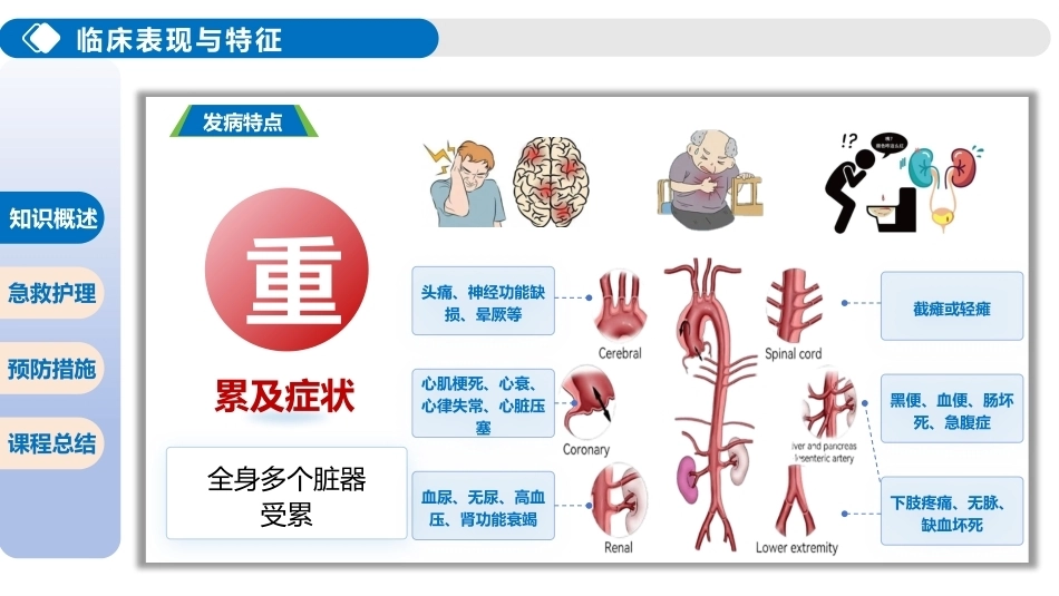 主动脉夹层破裂的急救护理_第10页