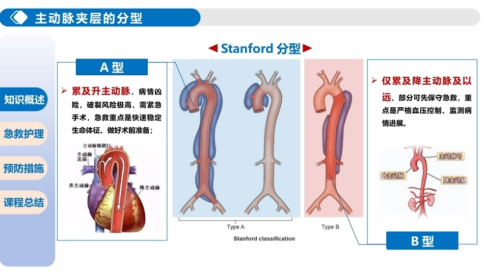 主动脉夹层破裂的急救护理_第6页