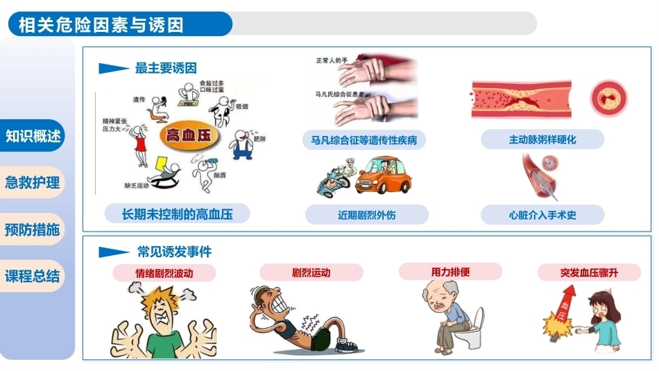主动脉夹层破裂的急救护理_第8页
