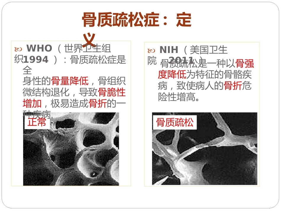 认识骨质疏松(最终版)_第4页